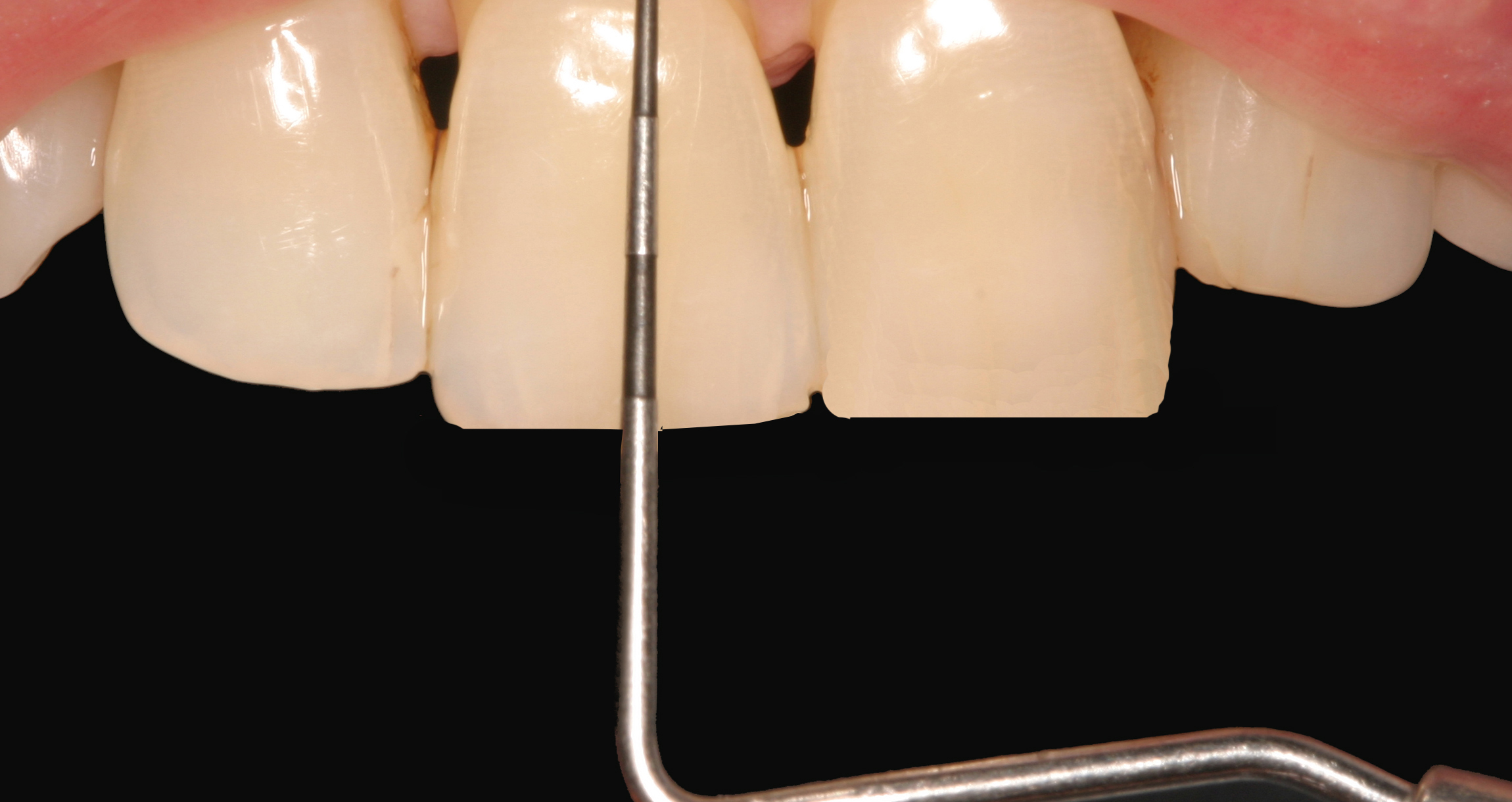 periodoncia 1