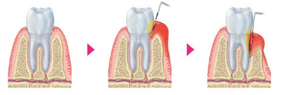 periodoncia 2